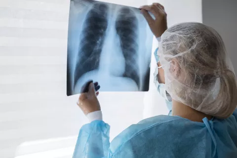Photo d'une radio médicale
