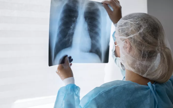 Photo d'une radio médicale 