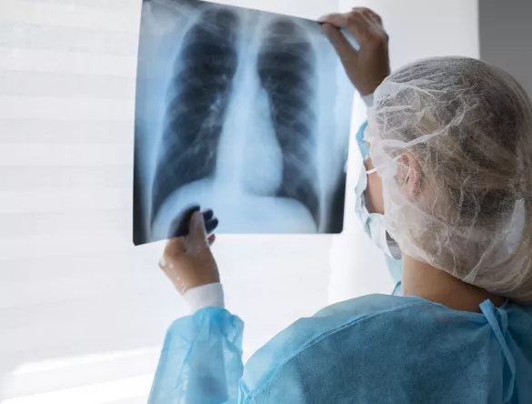 Photo d'une radio médicale 